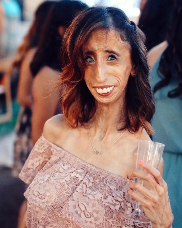 被攻击的最丑女人竟鼓舞千万人我的存在就是上帝的美意