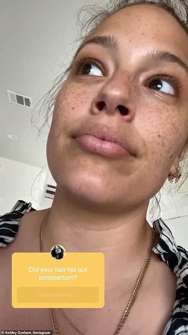 190斤大码模特晒素颜照,满脸雀斑很真实,自嘲睡眠少发际线后移