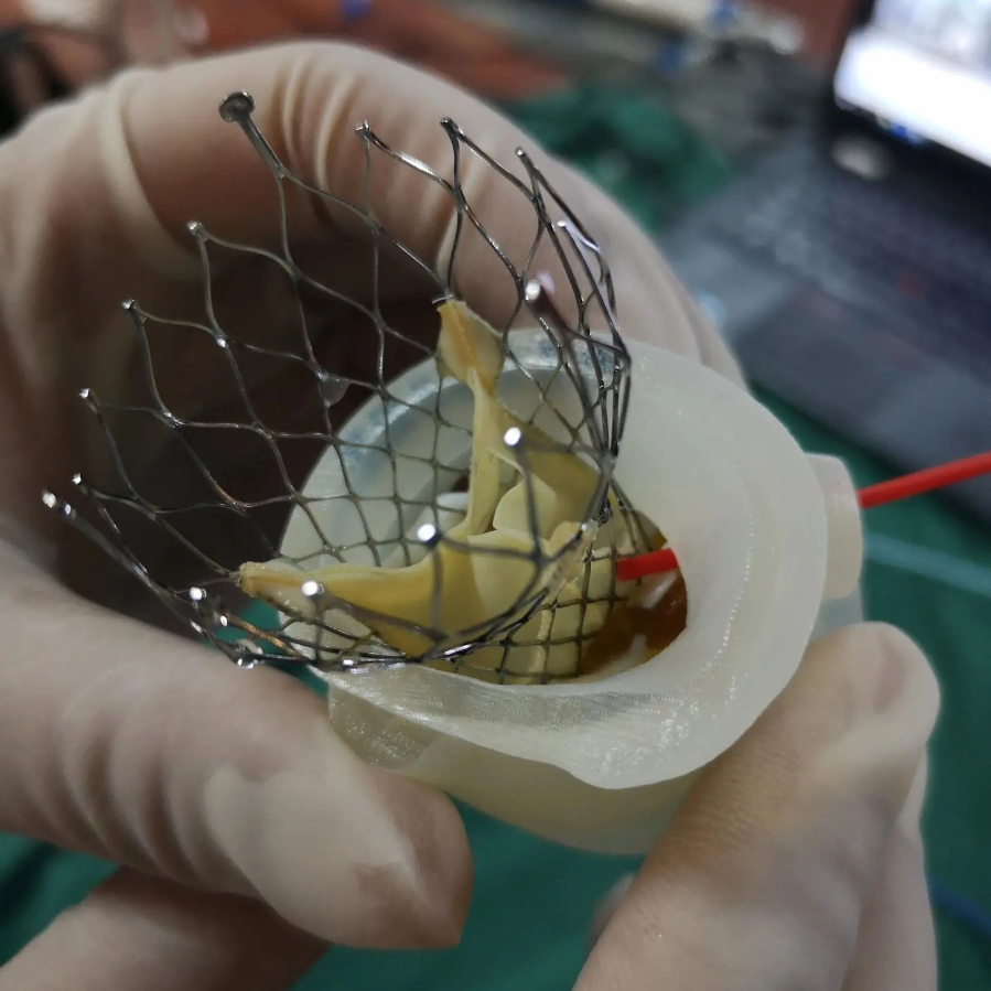 江西:3d打印心血管模型,南昌大学二附院成功完成省内第一例"3d tavr"