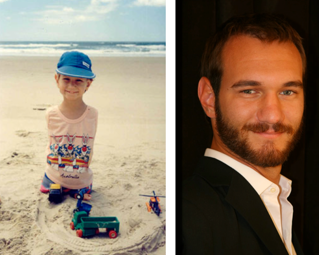 知乎800万浏览:一个刚出生就被医院判死刑的小婴儿