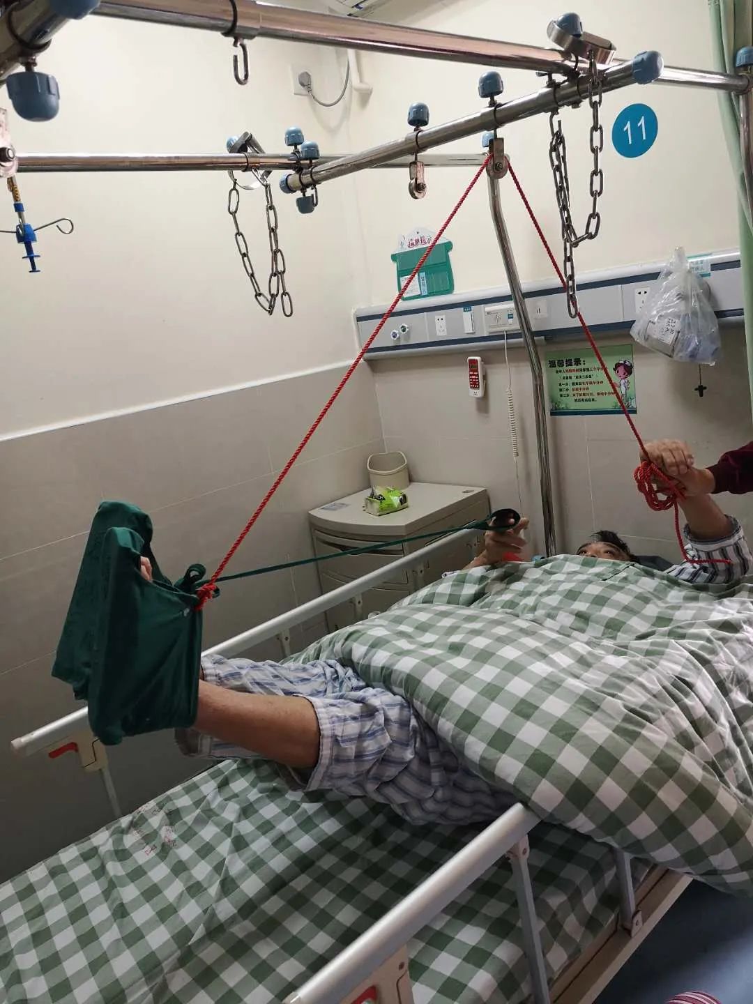 江门一工人坠楼,全身"散架"!医生奋力与"死神"抢人