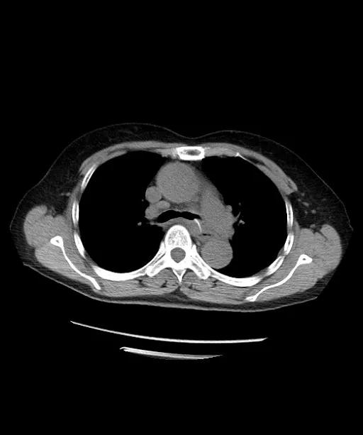 鱼刺卡喉求千万不要试图用饭团、馒头把鱼刺吞进去休闲区蓝鸢梦想 - Www.slyday.coM