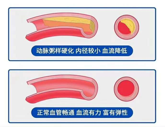 "三高"(高血压,高血糖,高血脂)人群怎么吃?调理方法看这里!