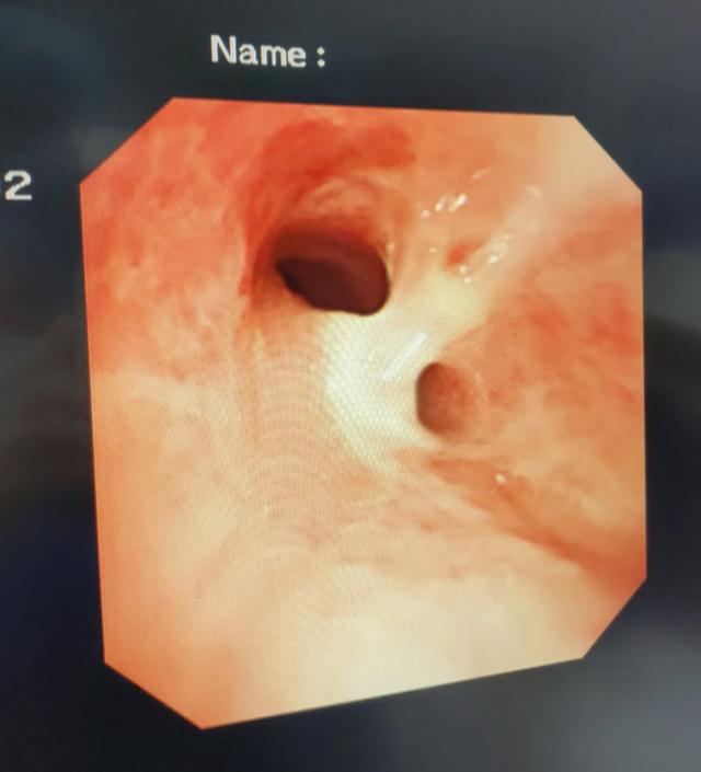 鱼刺卡喉求千万不要试图用饭团、馒头把鱼刺吞进去休闲区蓝鸢梦想 - Www.slyday.coM