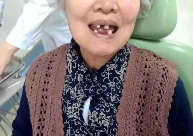 重磅江西户籍的享福了缺牙难看牙7月最新补贴计划出炉