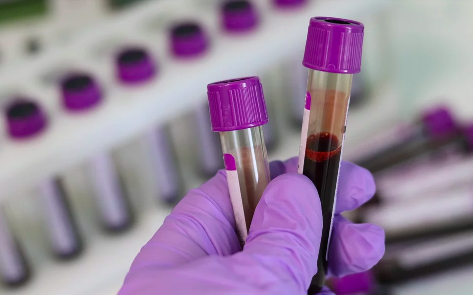 "抽一管血",就能发现你以后是否会患癌症?__财经头条