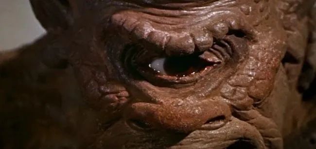 独眼巨人的传说可能是个大误会但独眼的畸形婴儿真的存在