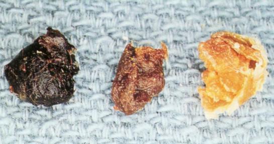 掏耳屎是个技术活，在家乱掏的后果和他一样休闲区蓝鸢梦想 - Www.slyday.coM