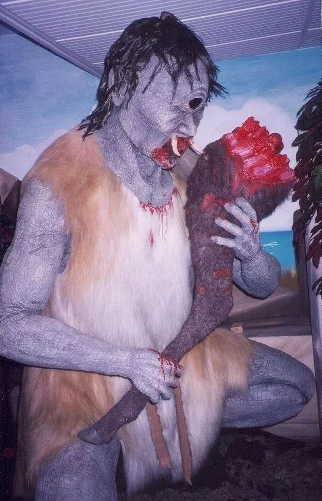 独眼巨人的传说可能是个大误会但独眼的畸形婴儿真的存在