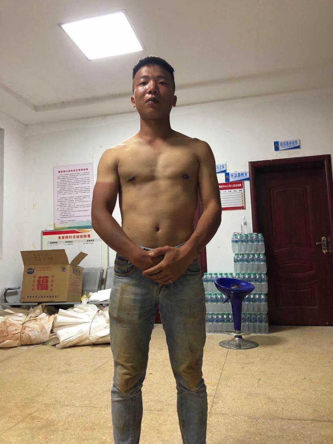 ▲通过镇日的声援做事,孙兴龙脸和胳膊被晒得黝暗。受访者供图。