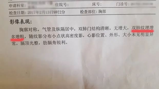 体检报告上写肺纹理增多增粗是不是病