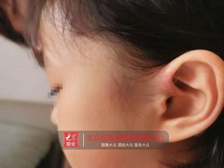 监控记录！淄博3岁女童上早教摔致头部骨折！警方介入调查