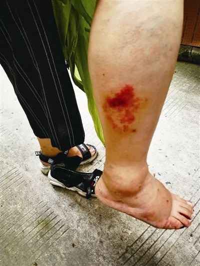 市区养蜜蜂20万只还蛰人三部门都没法管