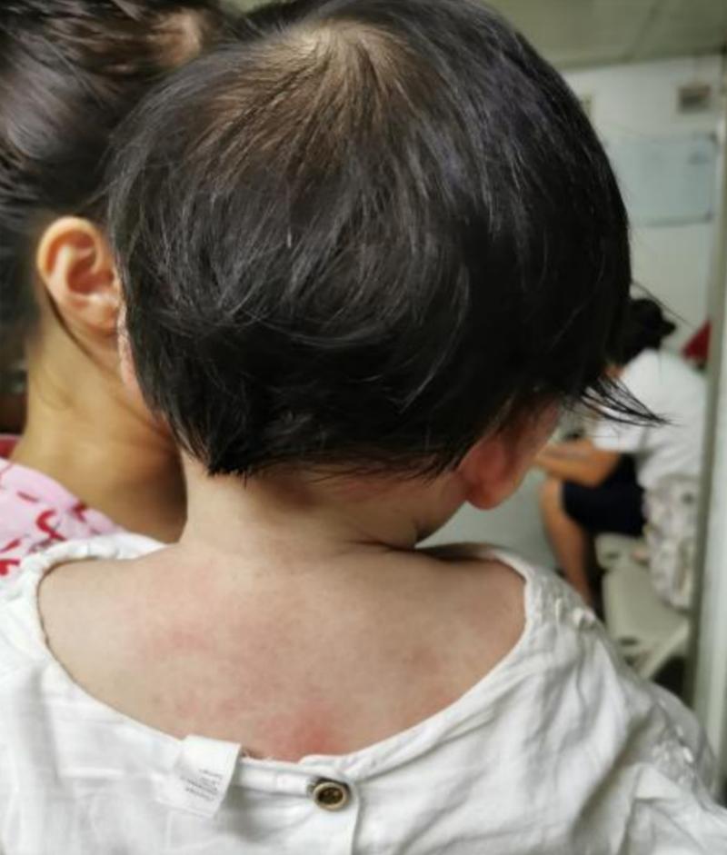 医生用按摩这一招治愈|斜颈|小儿|肿块_新浪新闻