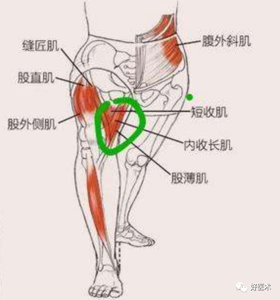 膝关节|股内侧肌|韧带损伤_新浪新闻