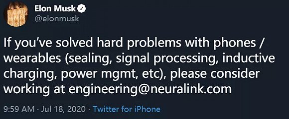 大脑直连音乐流？Neuralink脑机接口黑科技下月面世