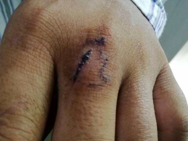 惠州“快递哥”挺身救人身中两刀！听他讲述救人细节休闲区蓝鸢梦想 - Www.slyday.coM