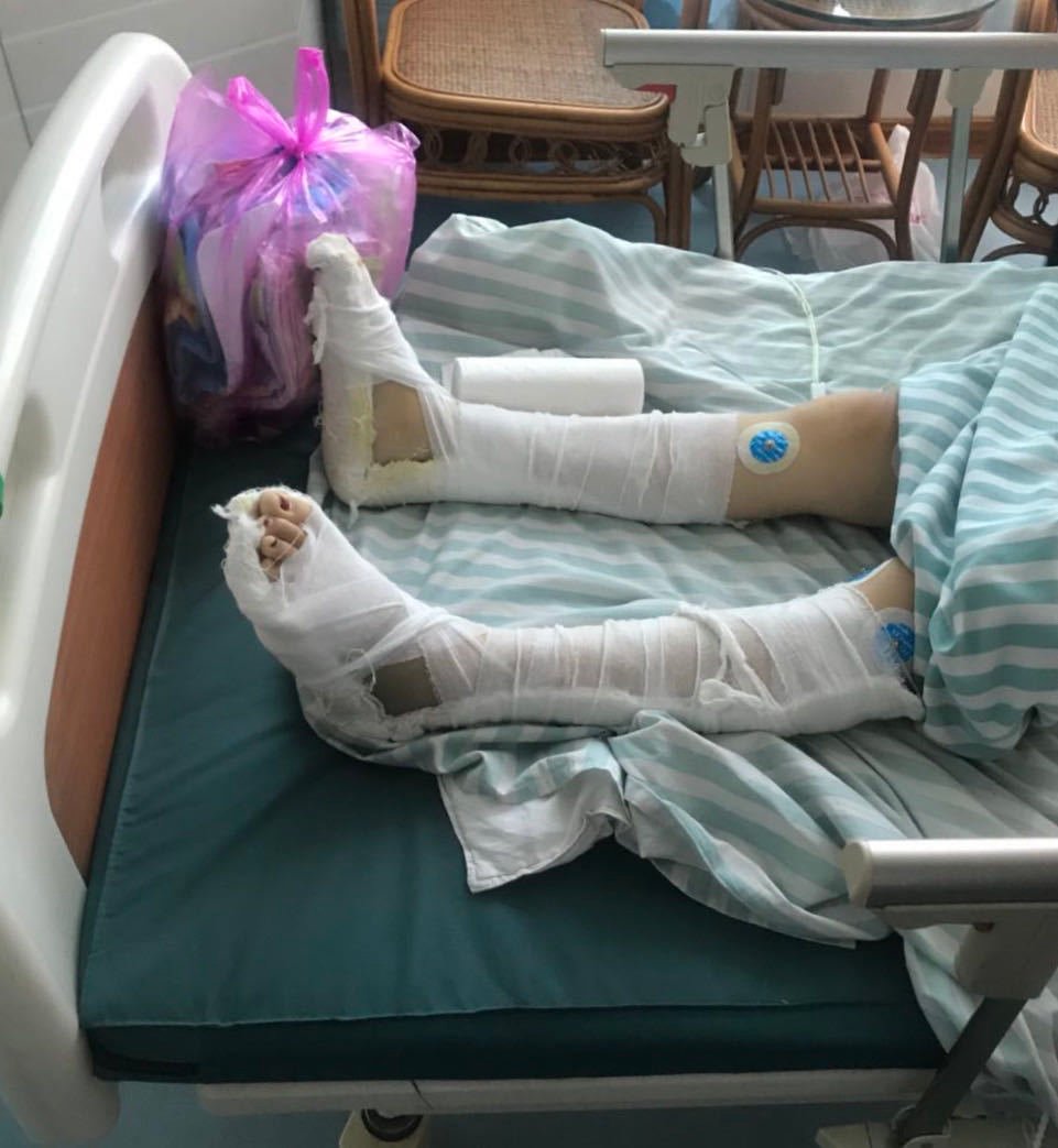 女子称不堪家暴跳楼致双下肢截瘫,当地妇联介入