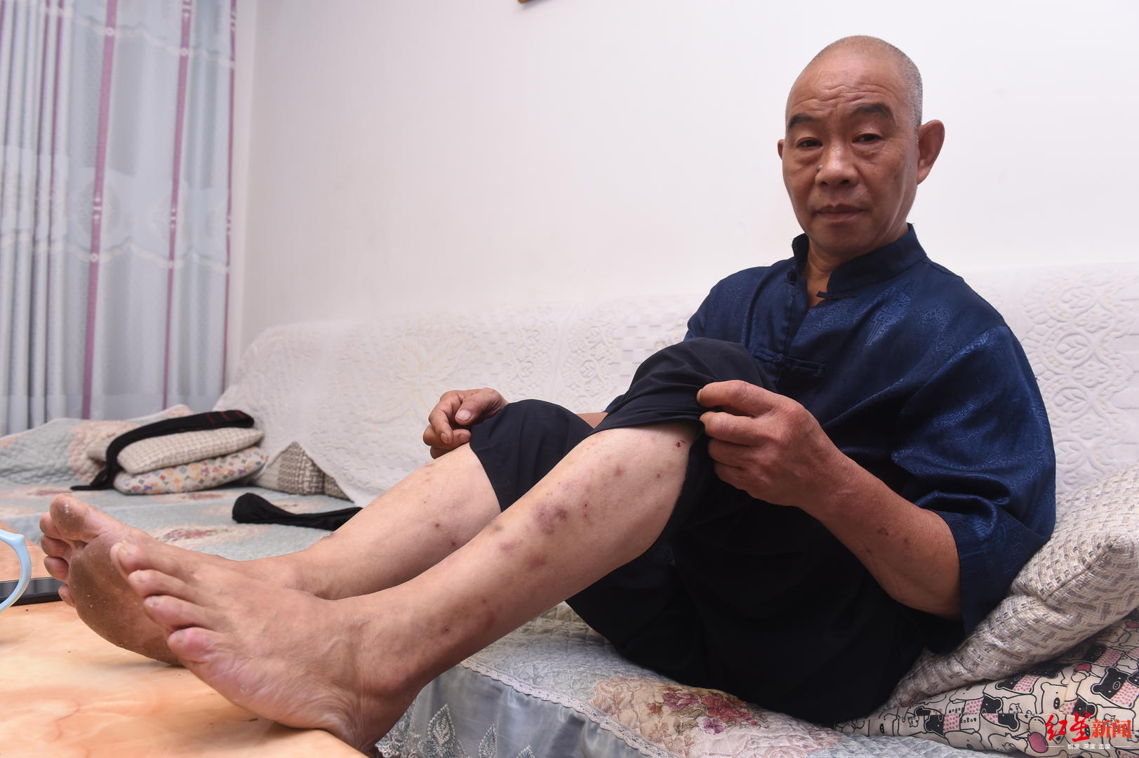 成都6旬大爷穿百斤"石鞋"散步 自创"石锁功"坚持40年,拒商演