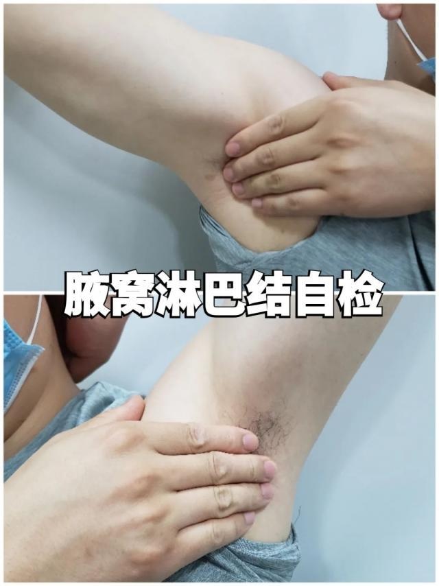 脖子还越来越粗|脖子|淋巴结|淋巴结肿大_新浪新闻