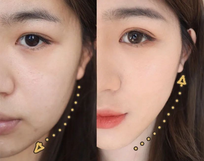 这个比瘦脸针还好用的好物既消水肿又提拉紧致立变小v脸