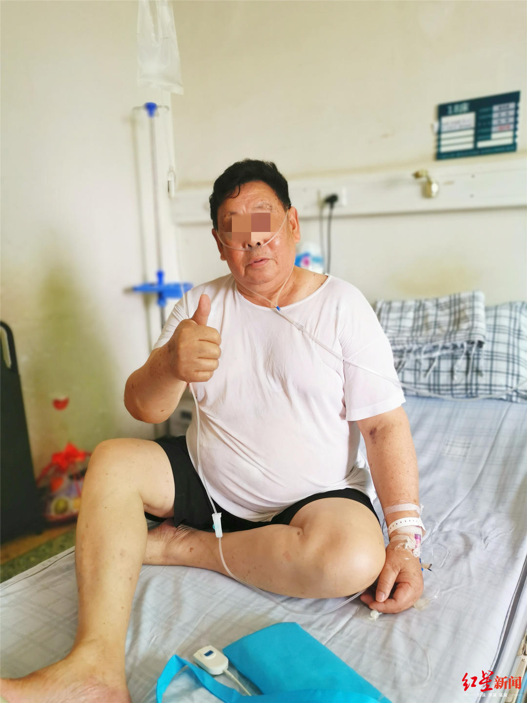 74岁老人胃动刀计划减重80斤 刷新西南地区外科减重者年龄新高