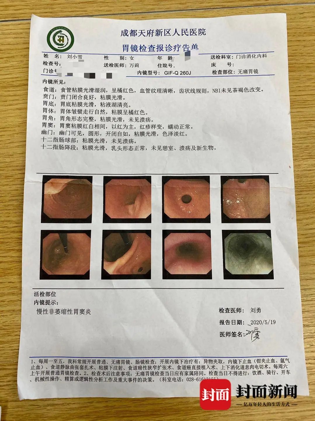 12天后刘小雪的胃镜结果