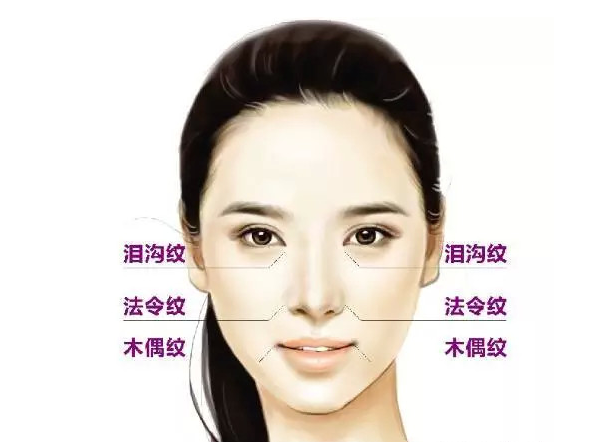 除了法令纹,泪沟纹,木偶纹也是让你显老的元凶,这三组"八"字样的