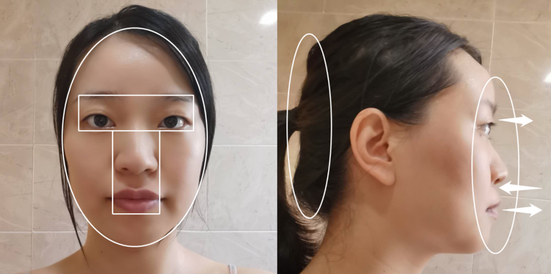 扁头长脸遭人诟病?摇身一变后国民初恋iu也要向她取经!