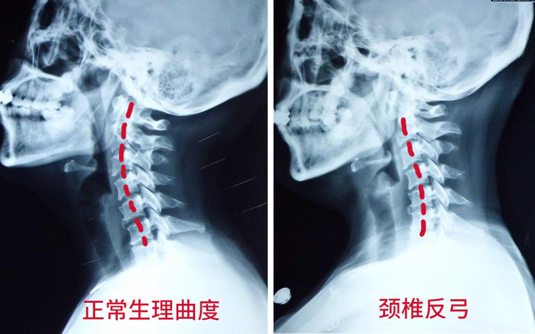 低头族必备 每天枕8分钟 躺出好身姿 告别颈椎痛 百匠优选 手机新浪网 低头族必备 每天枕8分钟 躺出好身姿 告别颈椎痛 百匠优选 手机新浪网