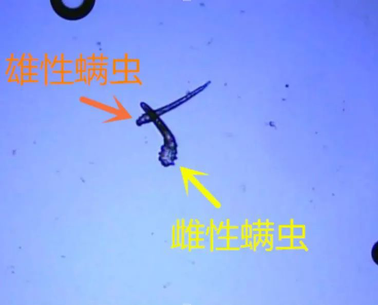 显微镜下观察到的蠕形螨/图片来源:医院提供