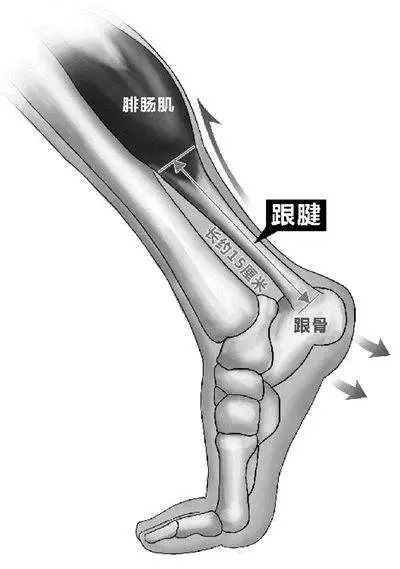 奔跑的心斗不过要刹车的身体,跟腱断裂为何"偏爱"运动员?