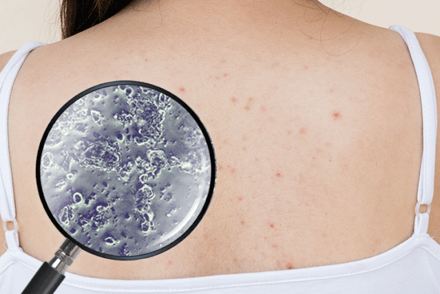 千元养肤精华做成沐浴球用它洗澡全身白嫩丝滑