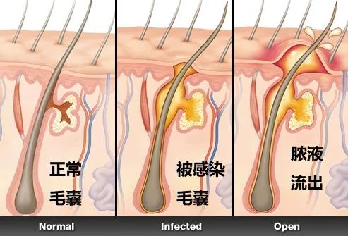 这是一道送命题啊!丨蝌谚more