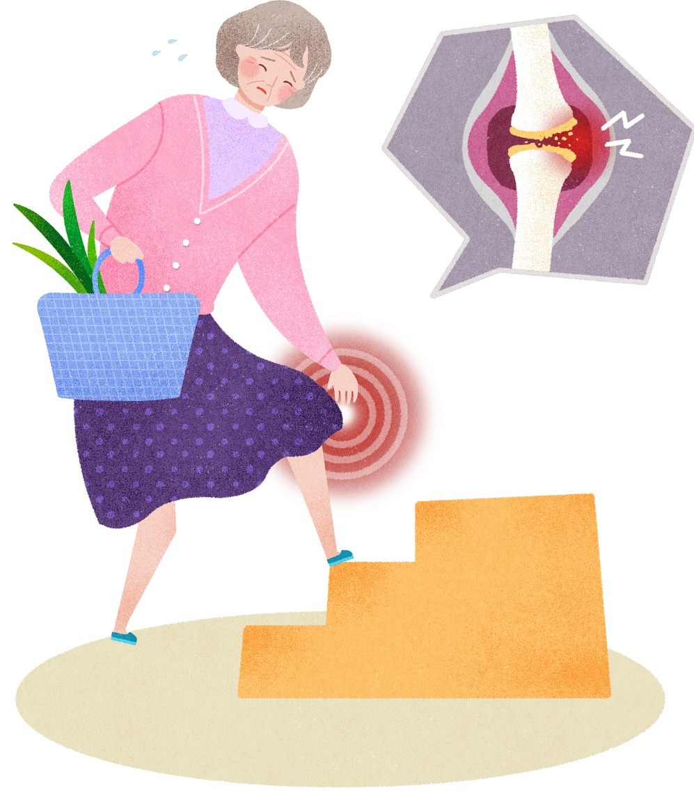 骨质疏松症为何偏爱女性四招教您强健骨骼