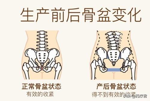 很多人愿意相信"妇女胯"的出现,是因为生宝宝时,骨盆被撑开了,因此生