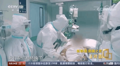 △国内顶尖肺移植专家，无锡市人民医院副院长陈静瑜。