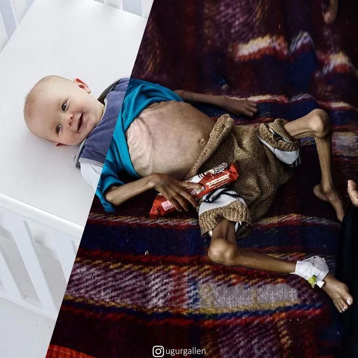 《饥饿的苏丹》,图中苏丹女童即将饿毙跪倒在地,而秃鹫正在女孩后方不