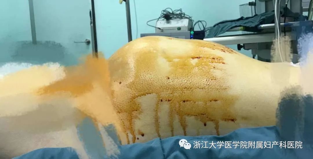 女孩肚子一天天隆起，妈妈反复追问原因，检查结果惊出冷汗！（组图） - 1