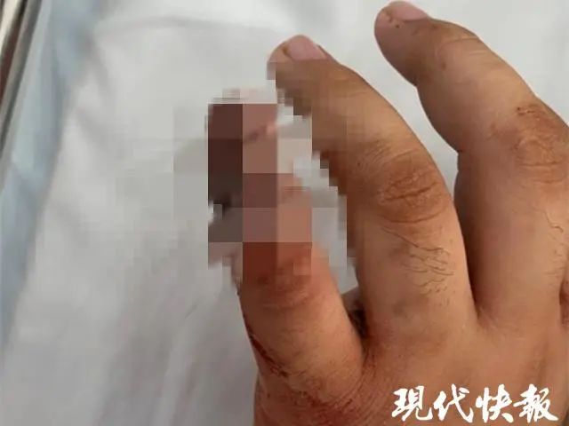吓傻 男子吃龙虾 一刀下去小拇指掉了 新浪新闻
