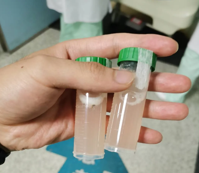经过3次肺泡灌气手术,依然还有浑水,水草