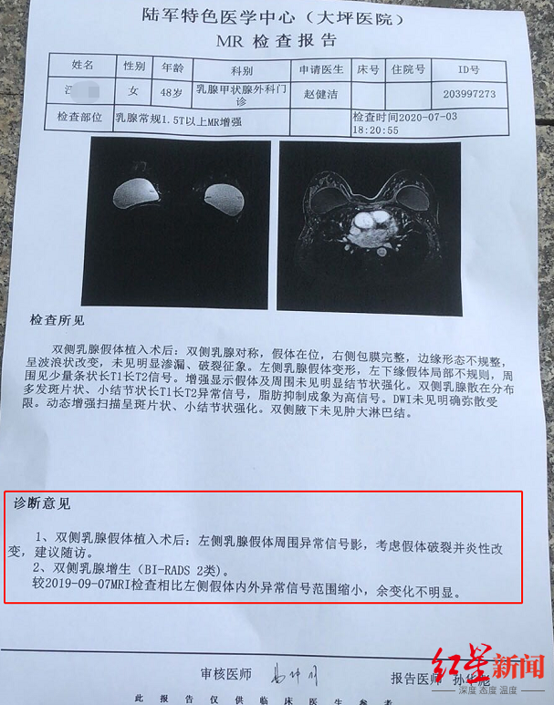 做隆胸的招牌医生竟是口腔专业女子术后疑似假体破裂整容门诊被罚2800