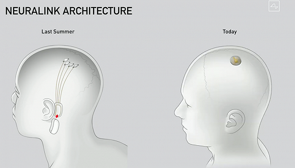 马斯克「脑机接口」：Neuralink 芯片硬币大小，机器人植入，猪先试了…_新浪科技_新浪网