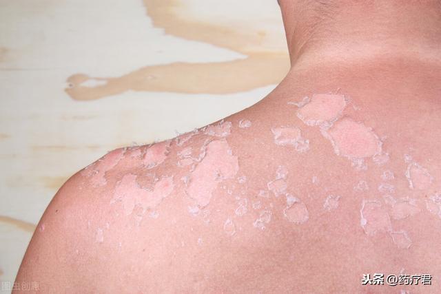 35高温下女子躺桥上暴晒一波操作惊呆了众人