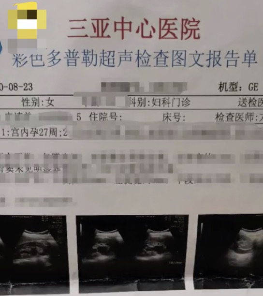孕妇撩衣做彩超时进来一个男人医院曾回应正常操作
