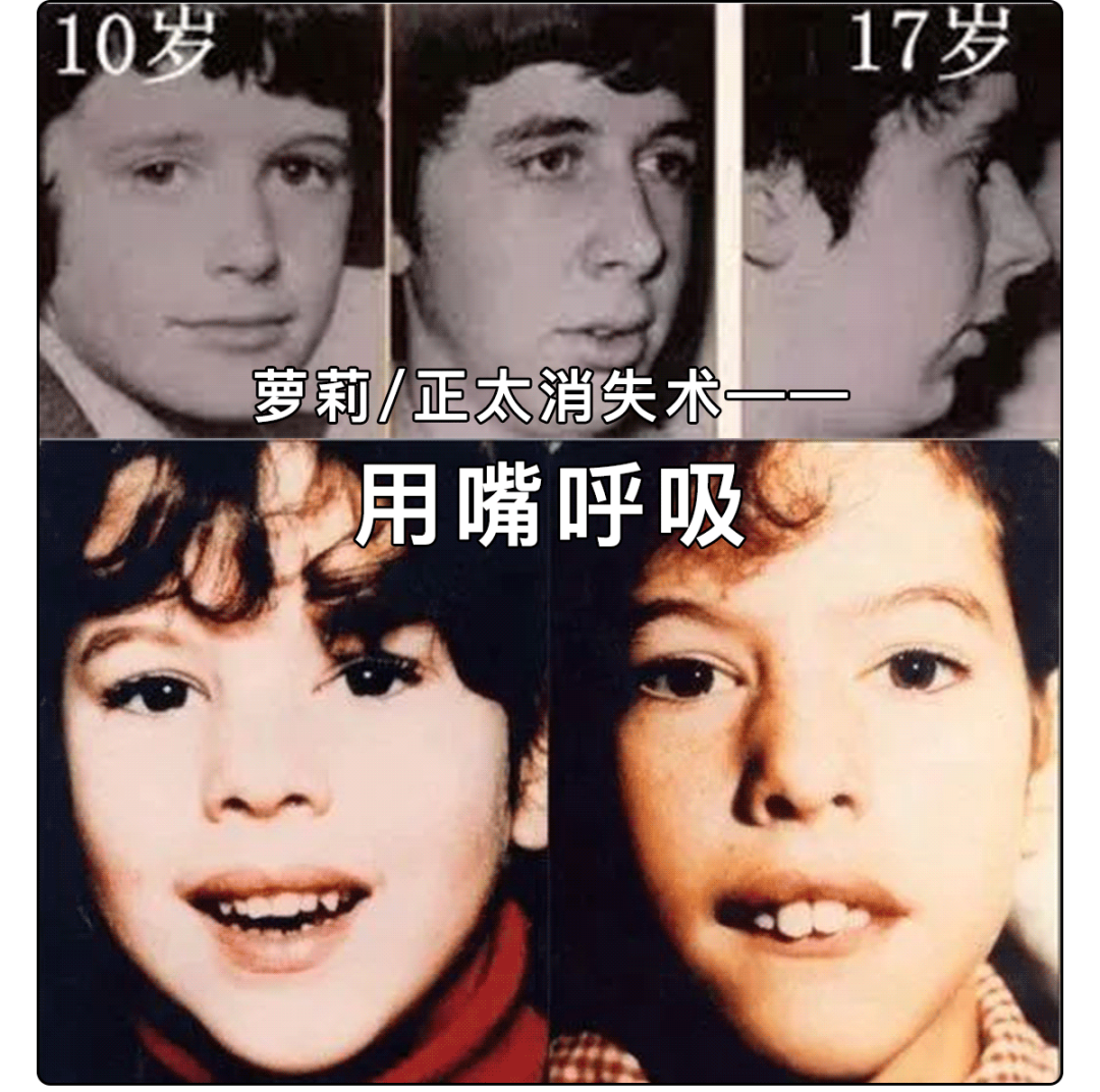 舍友   观察一下你睡觉的时候   是不是张着嘴   用鼻子还是用嘴呼吸