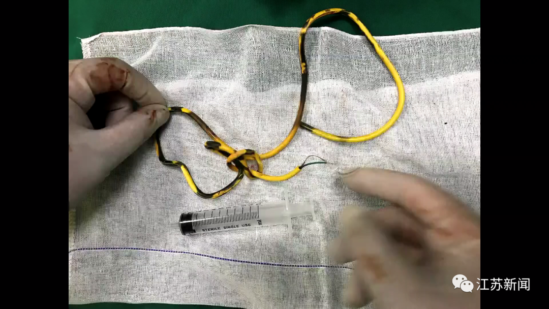 男性尿道较长,异物一旦进入后容易嵌顿,难以自行排出,异物留存尿道或