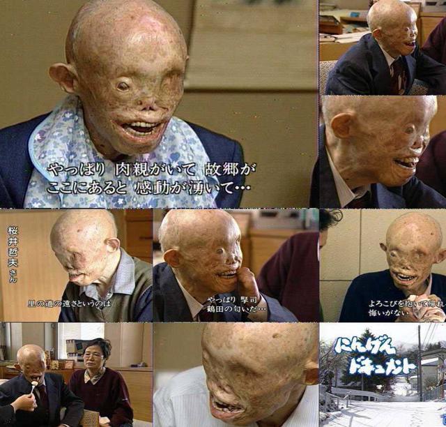 我国早已承诺不先动用核武器,若他人真的先手使用,来得及反应吗