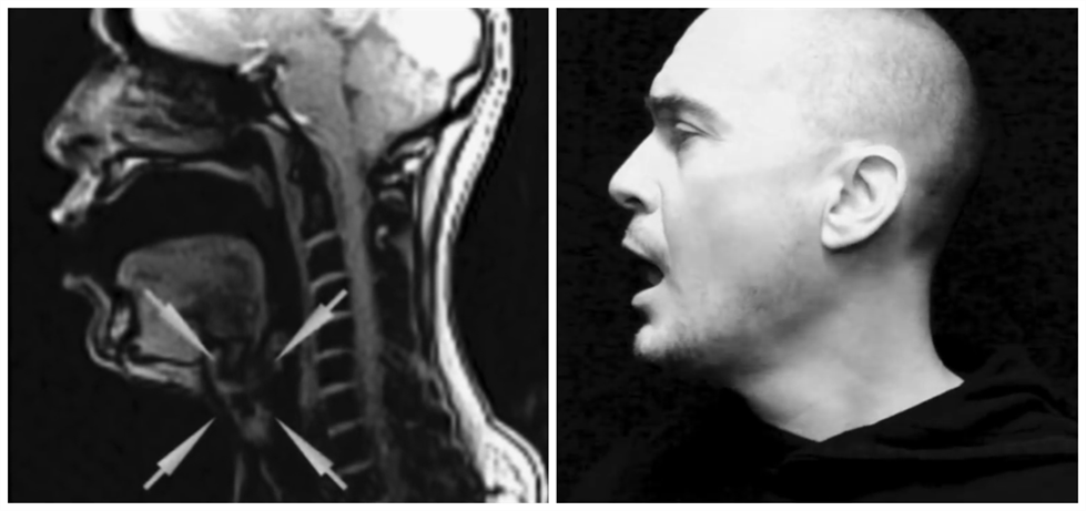 科学有意思 | 声音是如何从喉咙发出的?在核磁共振下唱歌试试