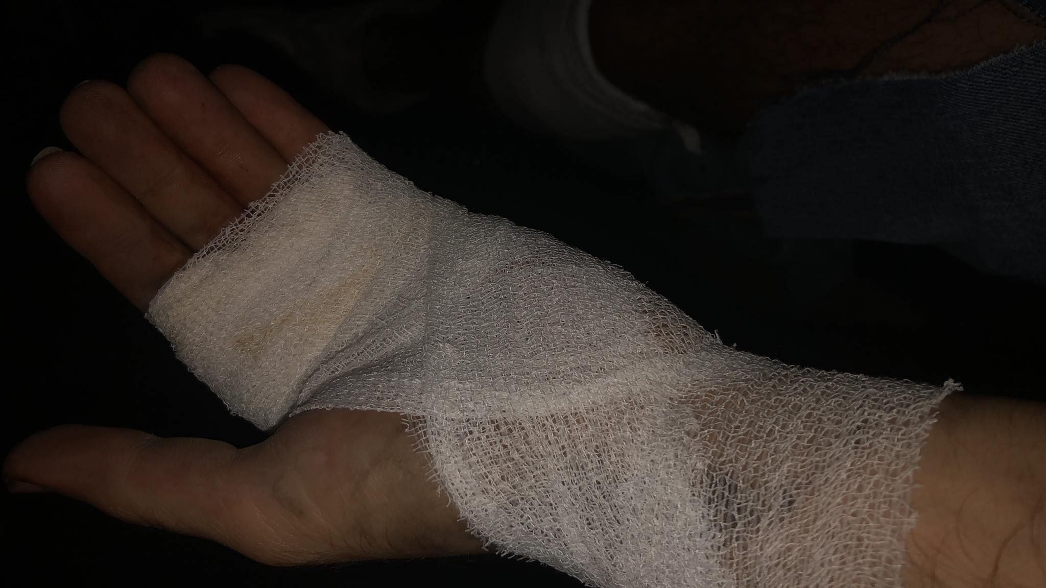 所幸除了一些割伤外,沙辛并无大碍.